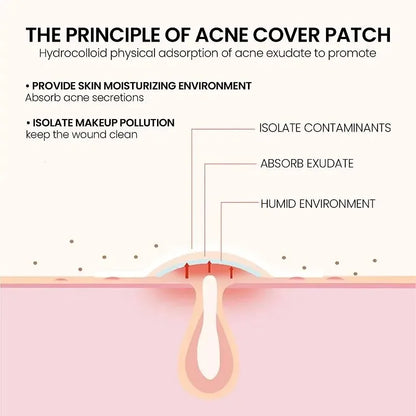 Acne Blemishes Cover Acne Pimple Repair Patch