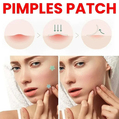 Acne Blemishes Cover Acne Pimple Repair Patch